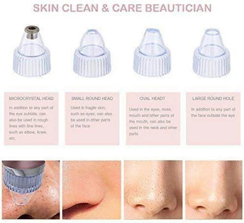 Black Heads Pore Cleaning Device