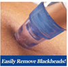 Black Heads Pore Cleaning Device